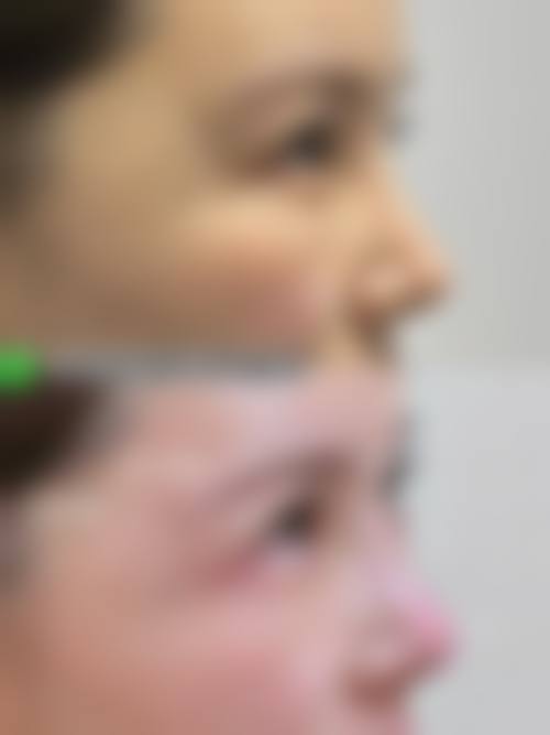 预约优惠活动:专属补贴助力变得更美