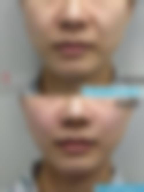 总结与预约号召