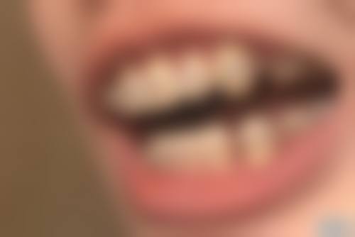 擅长项目详解