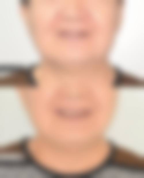 医生资质介绍:昆山市玉山镇嘉丽口腔苗利利靠谱吗?