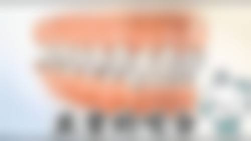 擅长项目详解