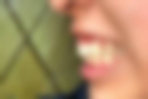 FAQ:关于昆山市玉山镇嘉丽口腔苗利利的常见问题