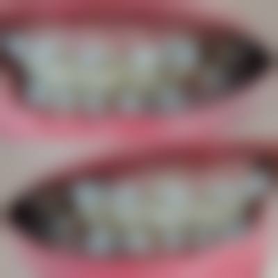 FAQ:关于合肥美奥口腔门诊部汪龙河的常见问答