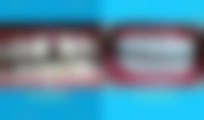 临床实例分享:治疗成效因人而异吗?