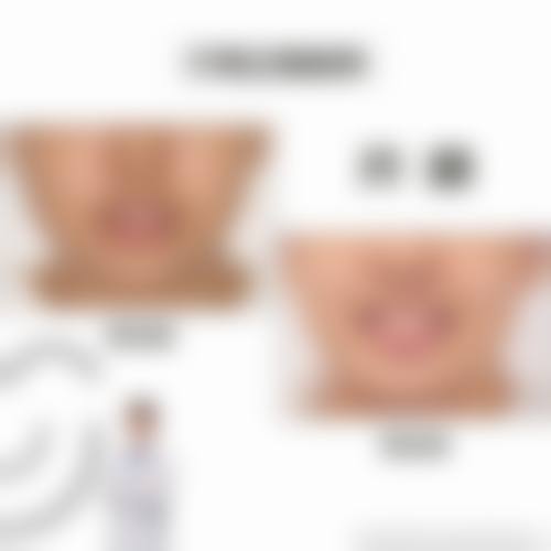 临床实例分享:吕翟医生临床实例