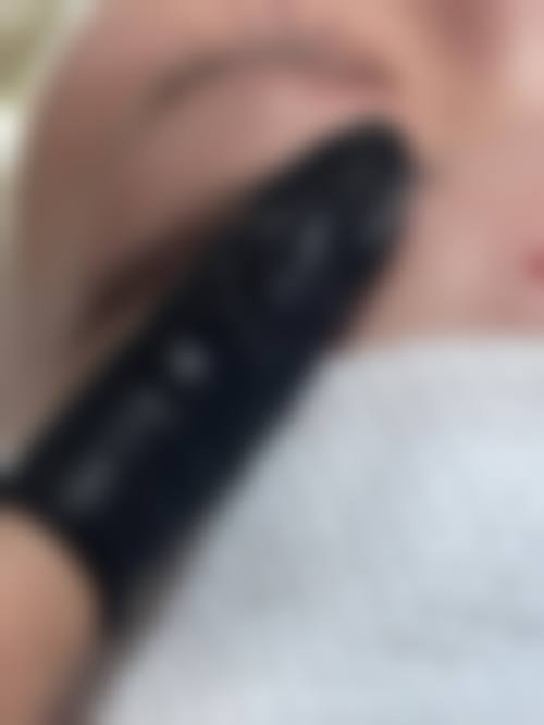 预约优惠活动:限时补贴不容错过