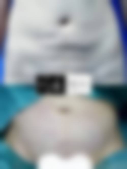 临床实例分享
