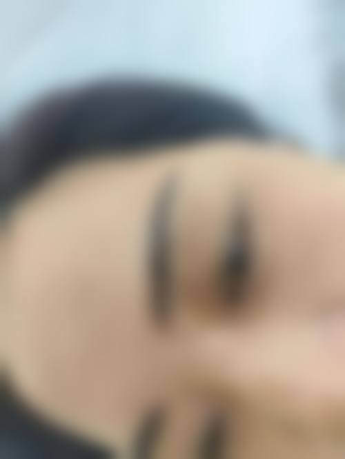 临床实例分享:张艺杰医生真实反馈汇总