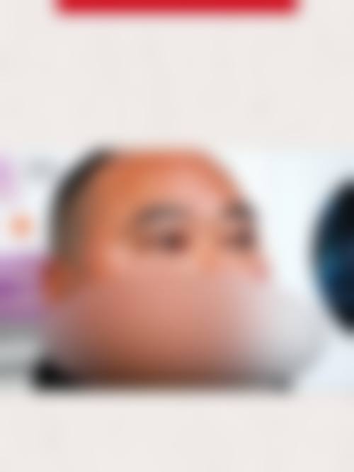 擅长项目详解
