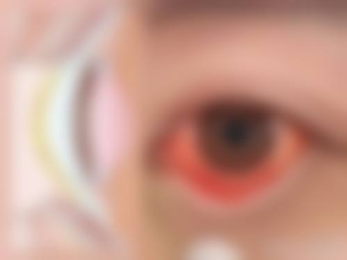 结尾预约号召:立即行动,拥抱清晰视界