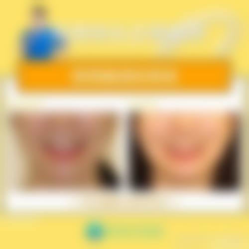 结尾预约号召:深圳铭德口腔门诊部缪思亮医生