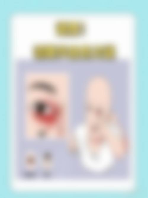 临床实例分享