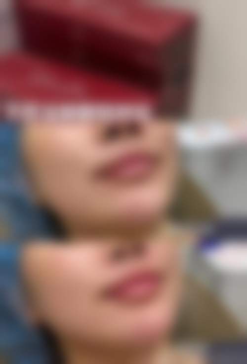 透明价格体系与优惠活动详情