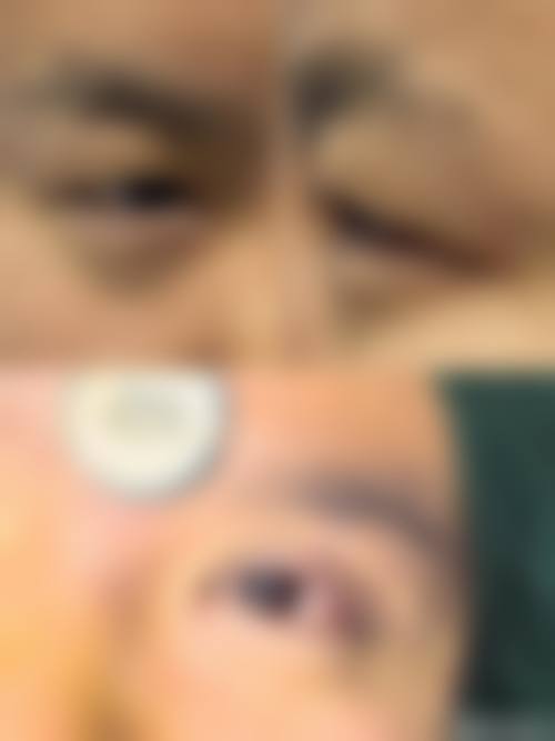擅长项目详解:精细解决各类眼部难题