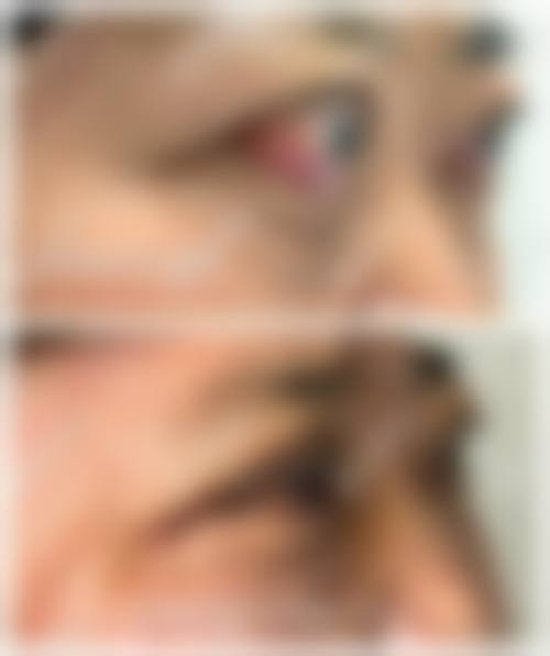 预约优惠活动