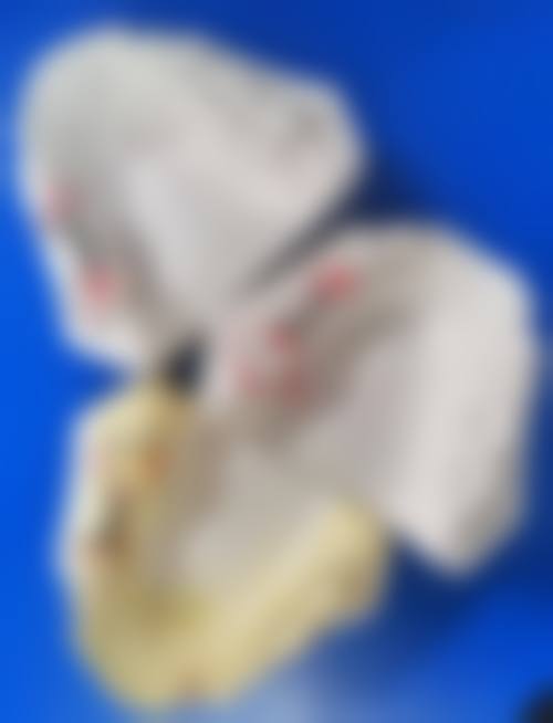 临床实例分享