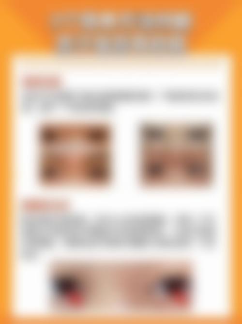 专精眼科设备配置与诊疗范围详解