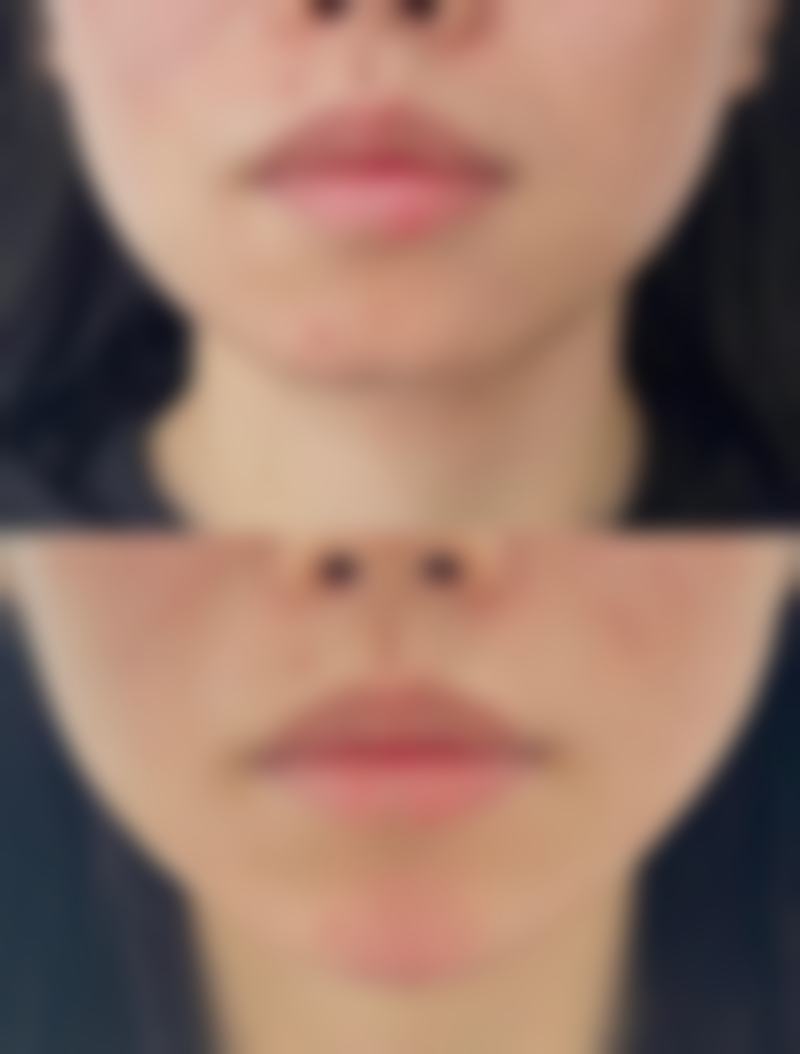 服务流程与患者保护
