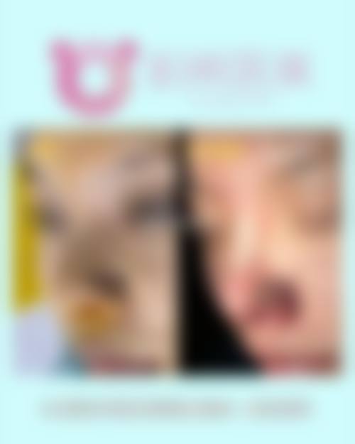精良设备与正版材料保护治疗安心