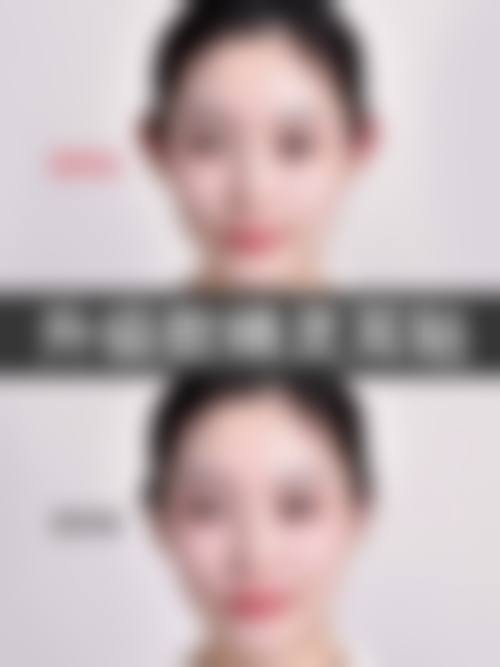 常见问题解答