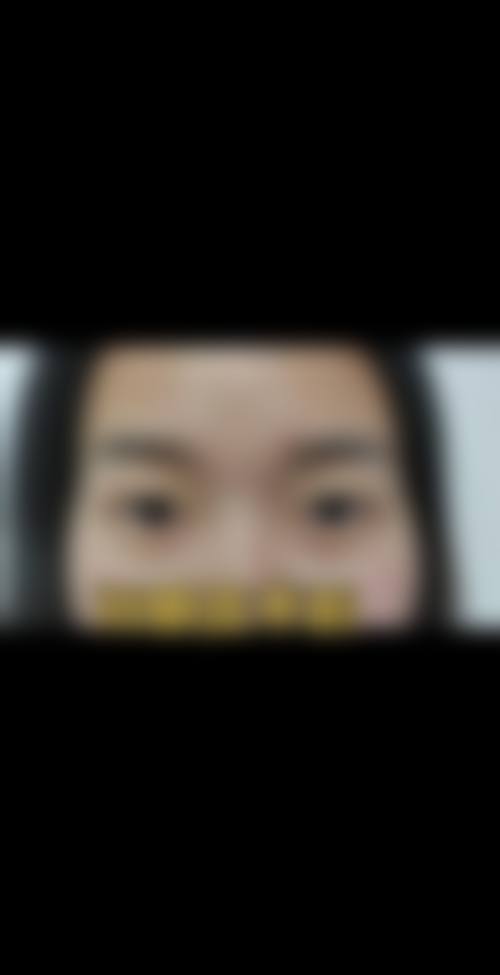 临床实例分享:南京市中医和西医结合医院眼科朱香成效如何