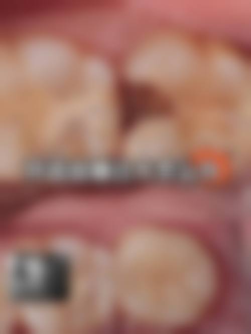 擅长项目详解