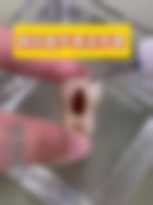患者真实评价