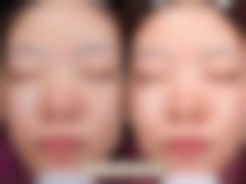 设备环境与师资:国内外标准配置保护治疗成效