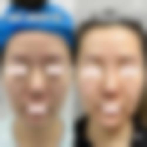 优惠活动与服务流程