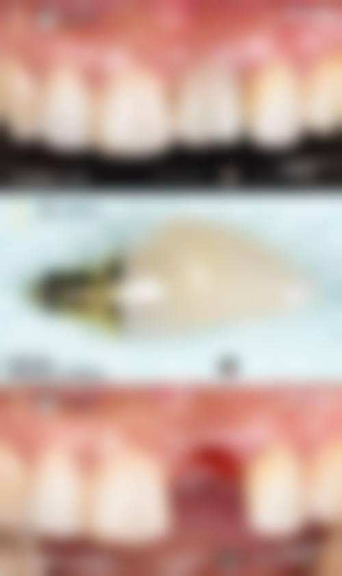 预约优惠活动:现在预约有什么补贴?
