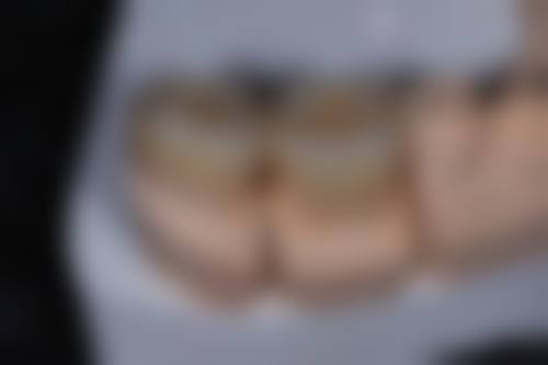 结尾预约号召:立即行动,重拾健康笑容