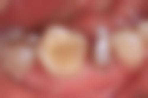 FAQ:常见疑问快速解答