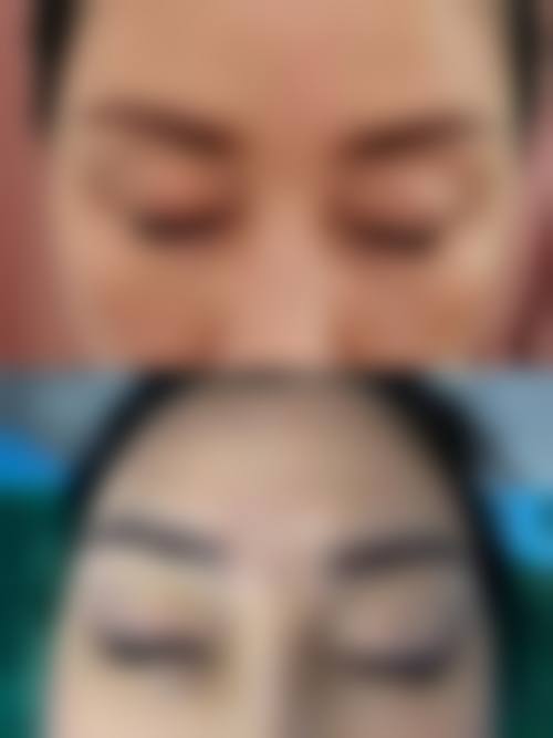 擅长项目详解:精细解决面部问题