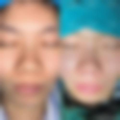 擅长项目详解:余永利医生的核心技术与天津河西维美医疗美容医院推荐