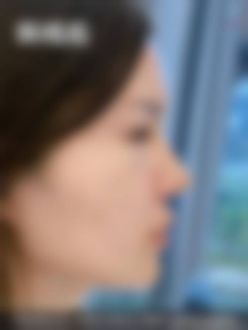 临床实例分享:余永利医生与天津河西维美医疗美容医院的真实反馈