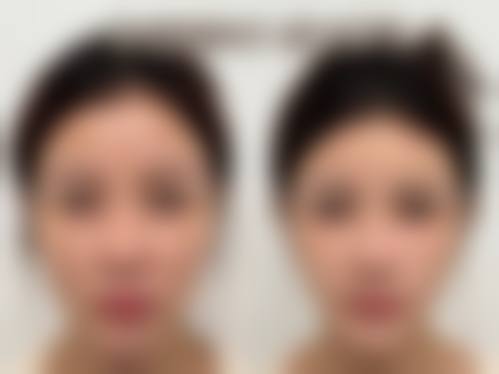 患者真实评价:余永利医生与天津河西维美医疗美容医院口碑见证