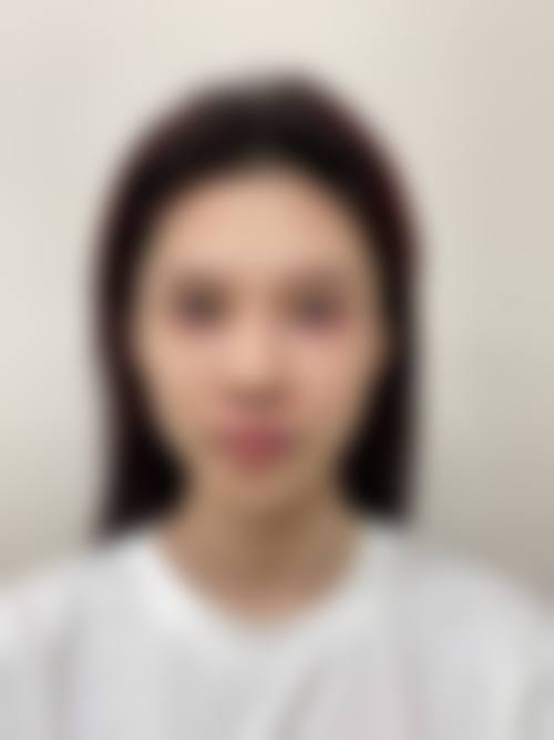 预约优惠活动:余永利医生与天津河西维美医疗美容医院专属补贴