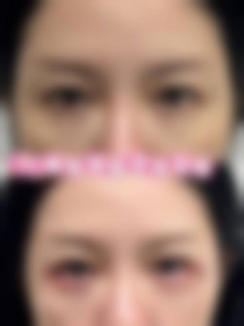 总结与预约号召
