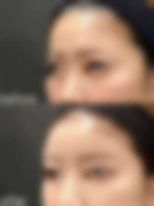 擅长项目详解：朱思瑾医生擅长做我需要的项目吗