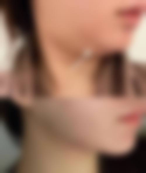 精良设备支撑精细医美与修复