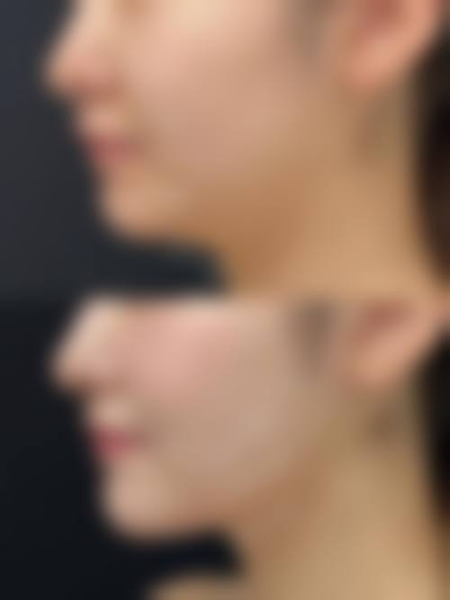透明价格体系,高性价比医美新选择