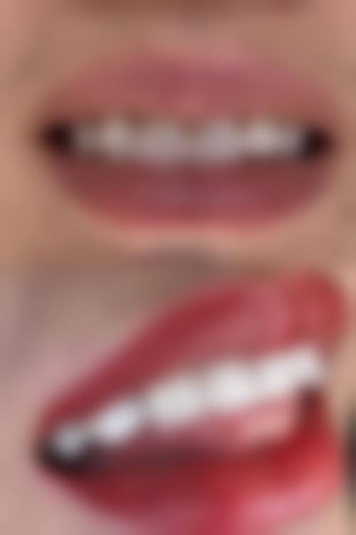 核心技术与设备优势:数字化赋能精细治疗