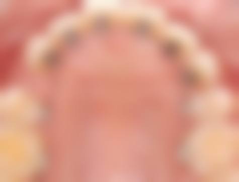 透明定价与近期优惠活动