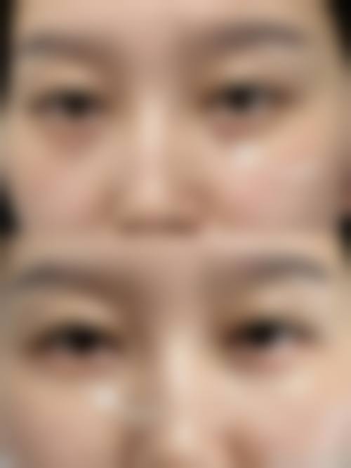 预约优惠活动