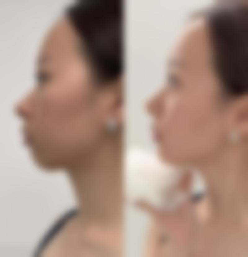 透明价格体系与优惠活动详情
