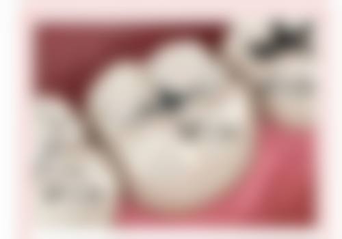 临床实例分享