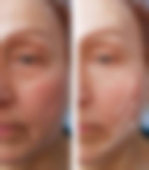 预约优惠活动