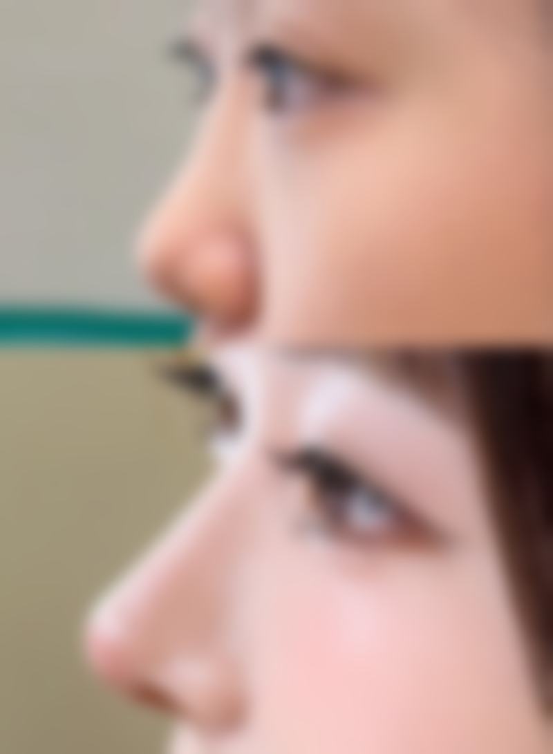 擅长项目详解