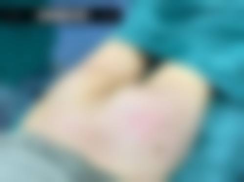 诊疗特色总结北京邦妍医疗美容门诊部甘春柳