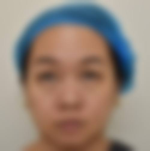 FAQ北京邦妍医疗美容门诊部甘春柳